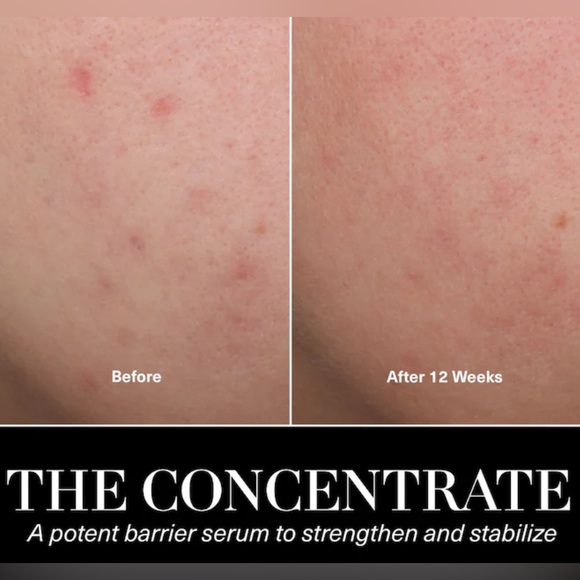 NWT💎La Mer The Concentrate Serum Barrier Miracle Broth Skin Care Oil Retail $225 - Picture 7 of 7